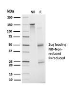 ATF2 Antibody in Immunoelectrophoresis (IE)