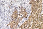 alpha Catenin Antibody in Immunocytochemistry (ICC/IF)