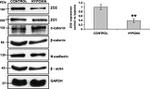 alpha Catenin Antibody in Western Blot (WB)