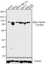 alpha Catenin Antibody in Western Blot (WB)