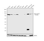 alpha Catenin Antibody in Western Blot (WB)