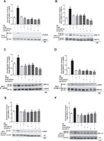 CaMKII beta Antibody in Western Blot (WB)