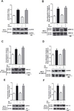 CaMKII beta Antibody in Western Blot (WB)