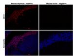 CD19 Antibody in Immunohistochemistry (Paraffin) (IHC (P))