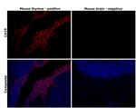 CD19 Antibody in Immunohistochemistry (Paraffin) (IHC (P))