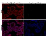 CD39 Antibody in Immunohistochemistry (Paraffin) (IHC (P))