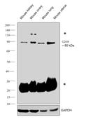 CD39 Antibody in Western Blot (WB)