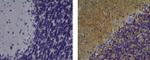 CD56 (NCAM) Antibody in Immunohistochemistry (Paraffin) (IHC (P))