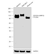 CD107b (LAMP-2) Antibody in Western Blot (WB)