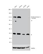 CD138 (Syndecan-1) Antibody in Western Blot (WB)