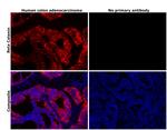 beta Catenin Antibody in Immunohistochemistry (Paraffin) (IHC (P))