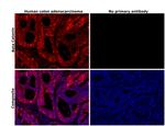 beta Catenin Antibody in Immunohistochemistry (Paraffin) (IHC (P))