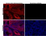 beta Catenin Antibody in Immunohistochemistry (Paraffin) (IHC (P))