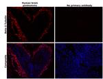 beta-3 Tubulin Antibody in Immunohistochemistry (Paraffin) (IHC (P))