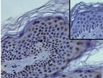 Mouse IgG1 kappa Isotype Control in Immunohistochemistry (Paraffin) (IHC (P))