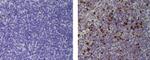 FOXP3 Antibody in Immunohistochemistry (Paraffin) (IHC (P))