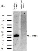 Amphiregulin Antibody in Western Blot (WB)