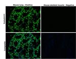 Podoplanin Antibody in Immunohistochemistry (Paraffin) (IHC (P))