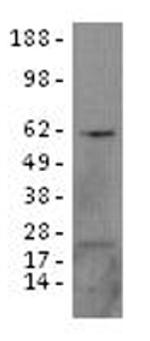 IKAROS Antibody in Western Blot (WB)