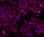 Osteopontin Antibody in Immunocytochemistry (ICC/IF)