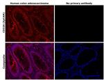 CD326 (EpCAM) Antibody in Immunohistochemistry (Paraffin) (IHC (P))