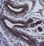 CD326 (EpCAM) Antibody in Immunohistochemistry (Paraffin) (IHC (P))