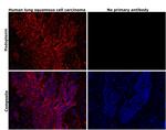 Podoplanin Antibody in Immunohistochemistry (Paraffin) (IHC (P))