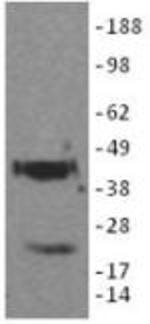 Podoplanin Antibody in Western Blot (WB)