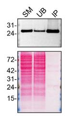 RAB5A Antibody in Immunoprecipitation (IP)