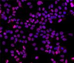 Estrogen Receptor alpha Antibody in Immunocytochemistry (ICC/IF)