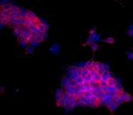 ErbB2 (HER-2) Antibody in Immunocytochemistry (ICC/IF)