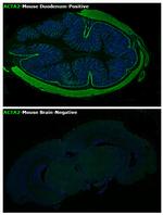 Alpha-Smooth Muscle Actin Antibody