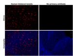 CD11c Antibody in Immunohistochemistry (Paraffin) (IHC (P))