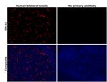 CD11c Antibody in Immunohistochemistry (Paraffin) (IHC (P))