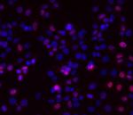 Progesterone Receptor Antibody in Immunocytochemistry (ICC/IF)