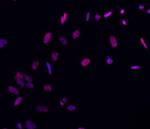 Brachyury Antibody in Immunocytochemistry (ICC/IF)