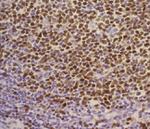 SOX11 Antibody in Immunohistochemistry (Paraffin) (IHC (P))