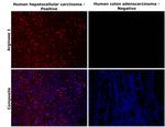 Arginase 1 Antibody