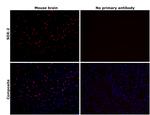 SOX2 Antibody in Immunohistochemistry (Paraffin) (IHC (P))