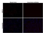 SOX2 Antibody in Immunohistochemistry (Paraffin) (IHC (P))