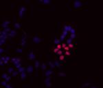 UTF1 Antibody in Immunocytochemistry (ICC/IF)