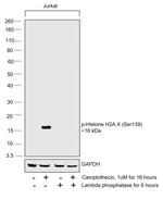 Phospho-Histone H2A.X (Ser139) Antibody