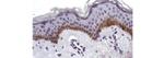 P-cadherin Antibody in Immunohistochemistry (Paraffin) (IHC (P))