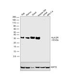 HLA-DR Antibody in Western Blot (WB)