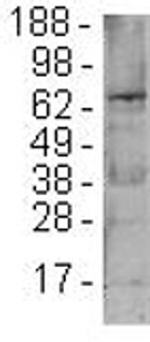 FOXP1 Antibody in Western Blot (WB)