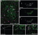 CD3 Antibody in Immunohistochemistry (IHC)