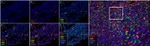 FOXP3 Antibody in Immunohistochemistry (IHC)