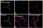 CD10 Antibody