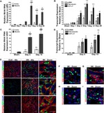 CD140b (PDGFRB) Antibody in Immunohistochemistry (IHC)