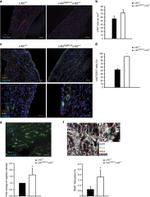 CD31 (PECAM-1) Antibody in Immunohistochemistry (IHC)